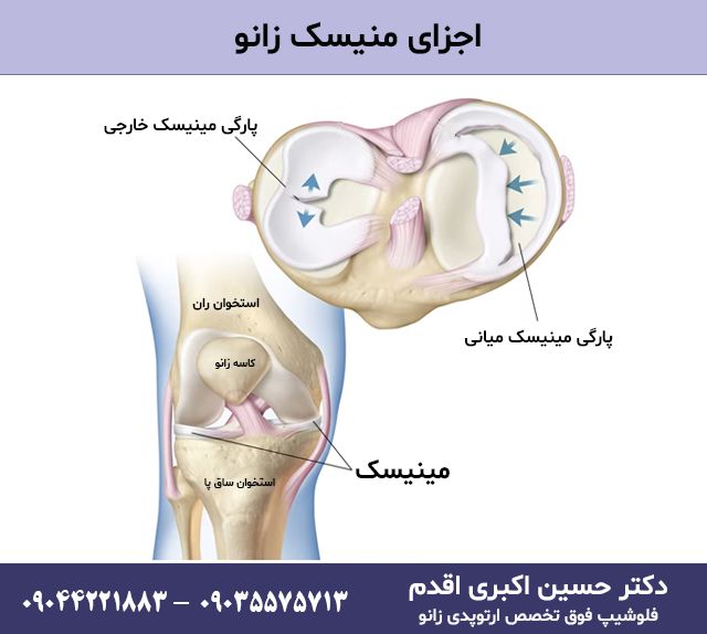 اجزای منیسک زانو2