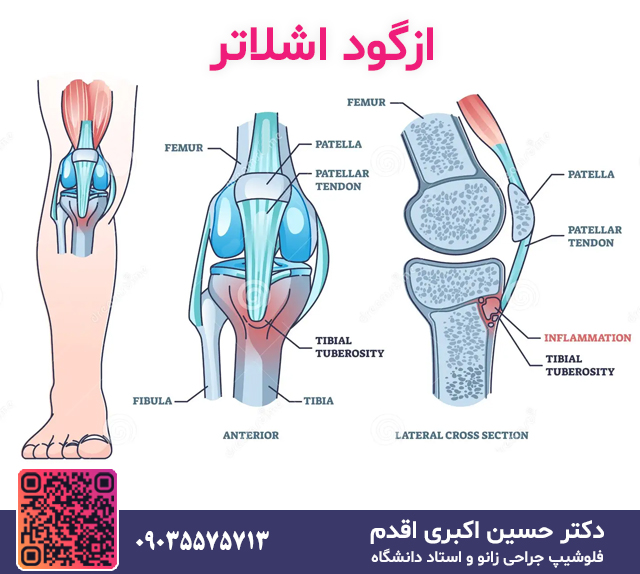 ازگود اشلاتر