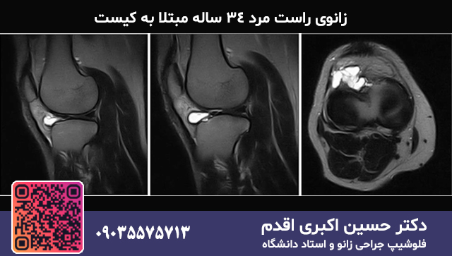 زانوی راست مرد